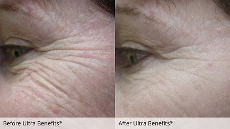 Ultra Benefits